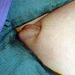 gömük penis gömük penis