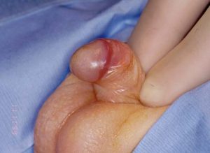 eğri penis