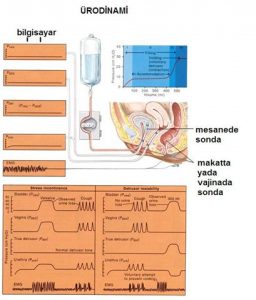 ürodinami